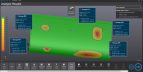 SmartDENT3D-Analysis