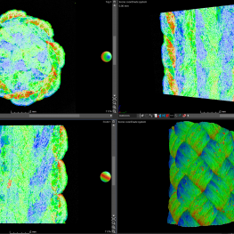 CT-Scanning – CT-Datenanalyse (II.)